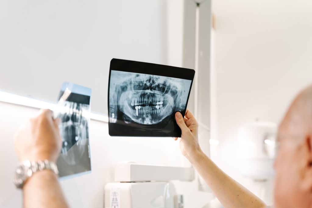 dentist examines two x rays of a patient's mouth