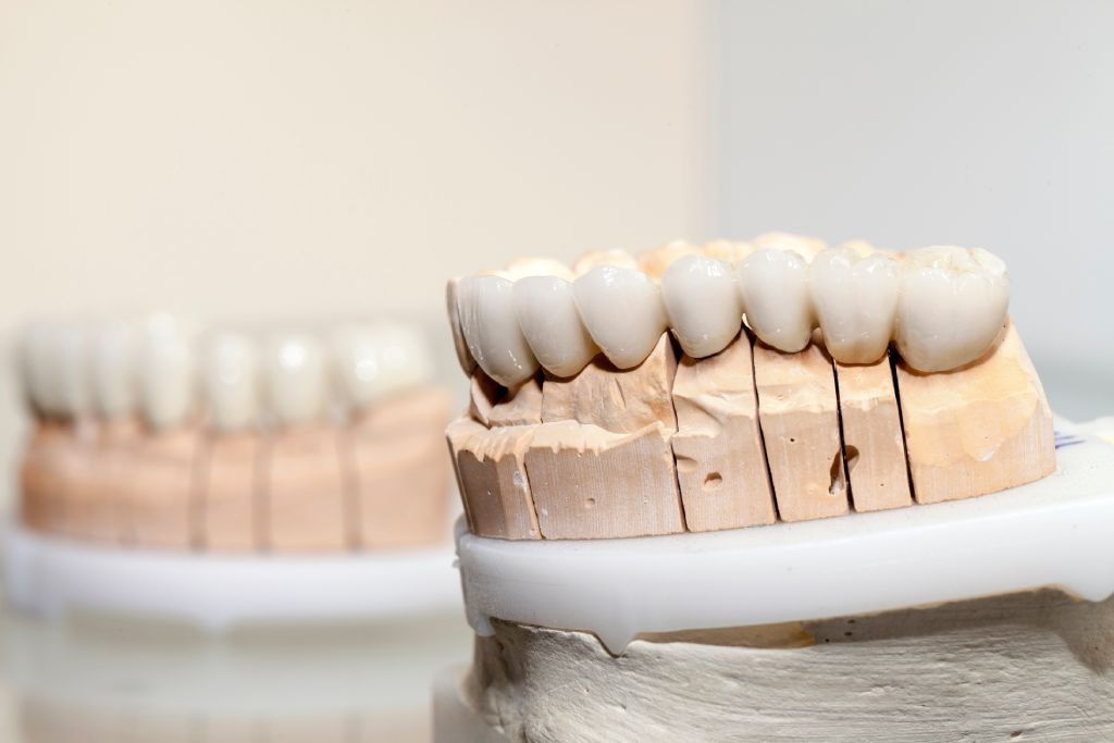 zirconium porcelain tooth plate in dentist store